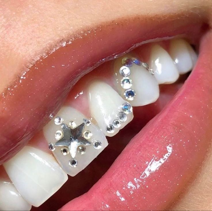 tooth gems